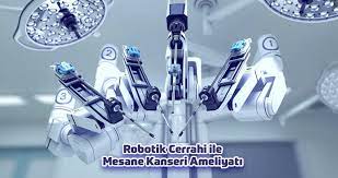 Robotik Cerrahi ile Mesane Kanseri Ameliyatı